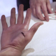 Illustration for article titled Tom Brady Reveals That His Thumb Injury Was Gross